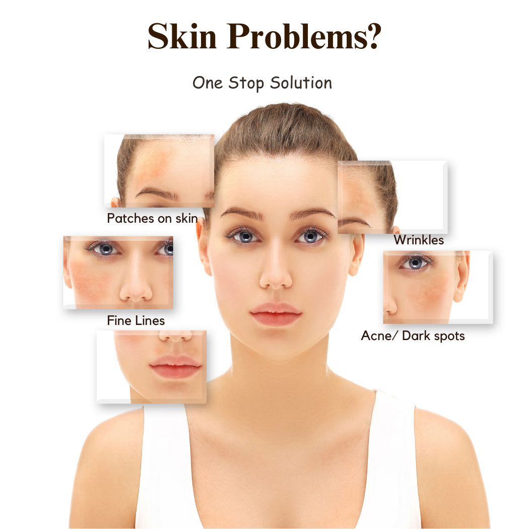 Image of Wood Pressed Almond Oil | Pure & Natural Extract | Virgin Roghan Badam | 100 ml